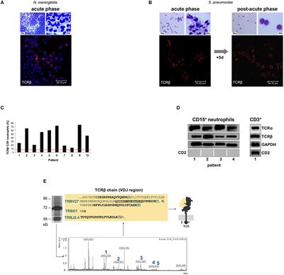 Immediate Neutrophil-Variable-T Cell Receptor Host Response in Bacterial Meningitis